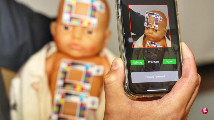 SingHealth and Synapxe develop BiliSG app to detect Jaundice in newborns