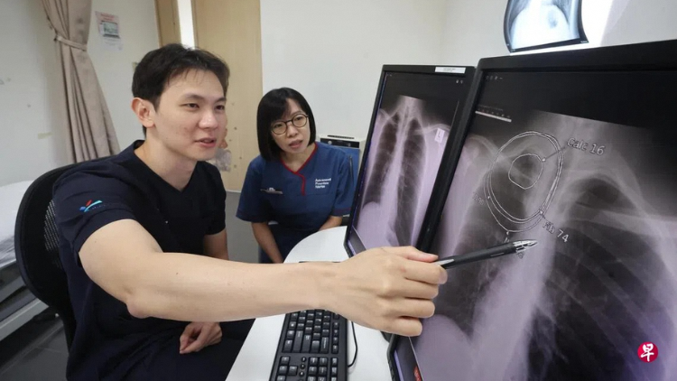 Tuberculosis Screening Centre Introduces AI "Reading Assistant" to Enhance Accuracy and Efficiency of Image Analysis