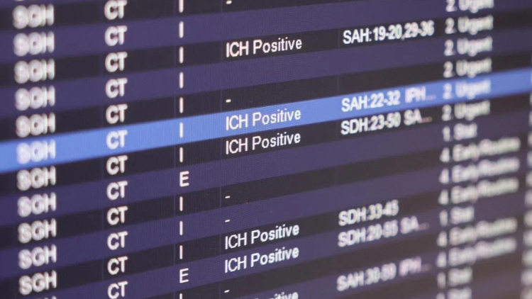 Scans that are picked up as positive for bleeding in the brain, or intracranial haemorrhage (ICH), by the AI tool would be clearly marked as “ICH positive”, whereas other scans will not show a reading. ST PHOTO: GIN TAY