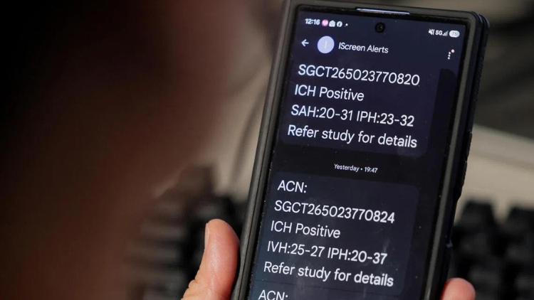 For scans that have been detected as positive for bleeding by the AI model, the system will automatically send an SMS alert to both the radiologist and attending doctor. ST PHOTO: GIN TAY